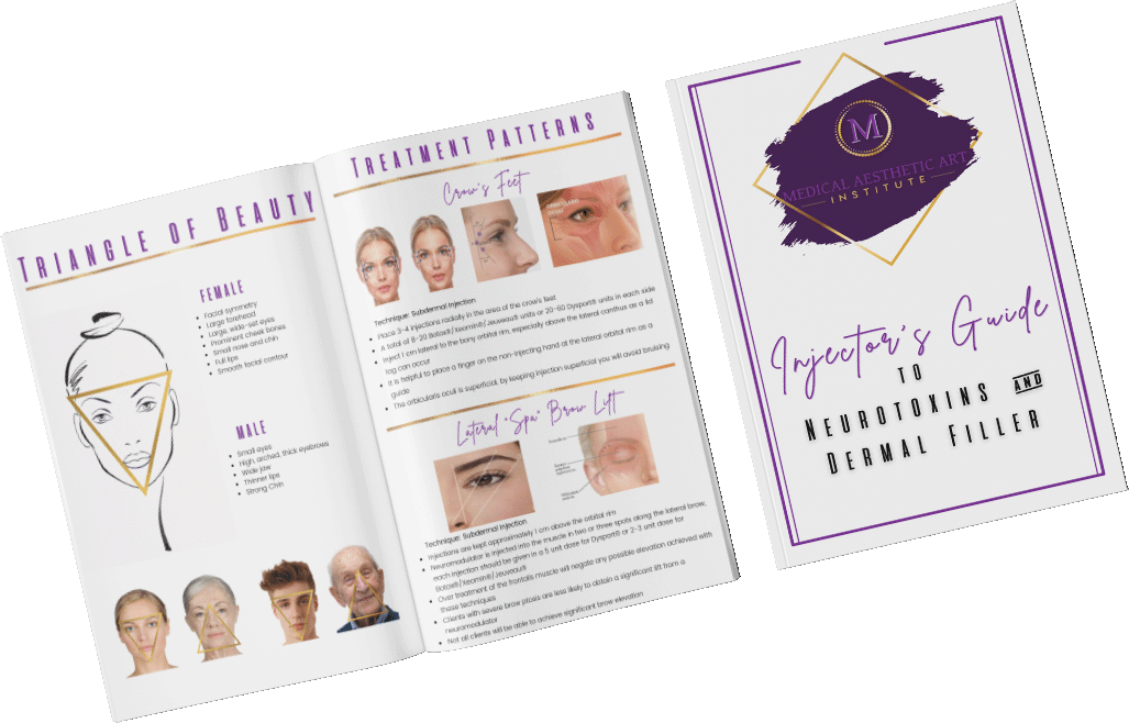 MAAI - Injector's Guide